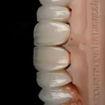 استخدام منشی جهت لابراتوار دندانسازی در نیروی دریایی تهران