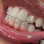 نیازمند منشی و دستیار دندانپزشک جهت مطب در ملارد تهران