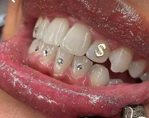 نیازمند منشی و دستیار دندانپزشک جهت مطب در ملارد تهران