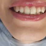 نیازمند دستیار و منشی دندانپزشکی جهت مطب در بهارستان اصفهان