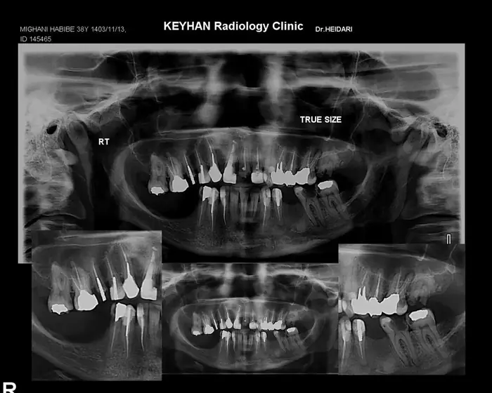 استخدام منشی خانم جهت مطب دندانپزشکی در گرگان