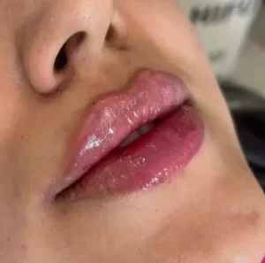 دعوت به همکاری از پزشک زیبایی دارای پروانه جهت کلینیک زیبایی در بلوار قرنی یاسوج