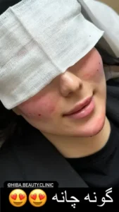 استخدام اپراتور لیزر جهت کلینیک زیبایی در برازجان استان بوشهر