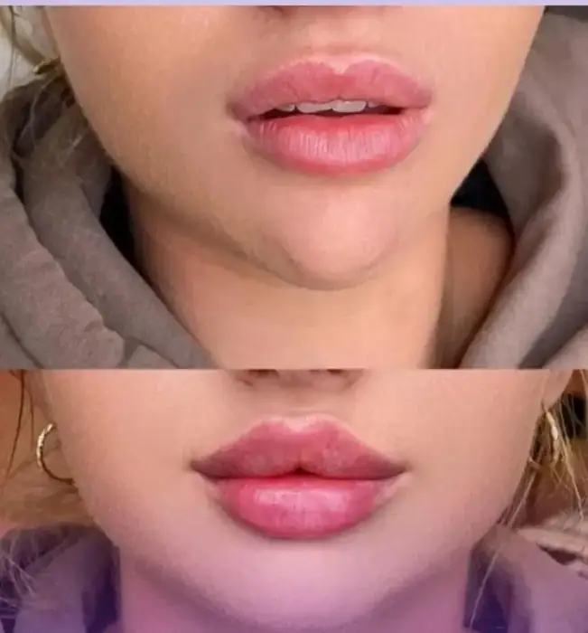 استخدام منشی جهت کلینیک زیبایی معتبر در خاک سفید تهران