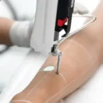 استخدام اپراتور لیزر خانم جهت کلینیک در خیابان مطهری مشهد