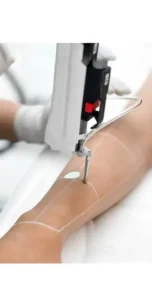 استخدام اپراتور لیزر خانم جهت کلینیک در خیابان مطهری مشهد