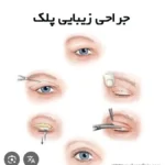 نیازمند جراح چشم یا جراح عمومی مسلط به عمل های زیبایی جهت مجموعه معتبر زیبایی در تهرانسر شمالی تهران