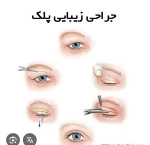 نیازمند جراح چشم یا جراح عمومی مسلط به عمل های زیبایی جهت مجموعه معتبر زیبایی در تهرانسر شمالی تهران