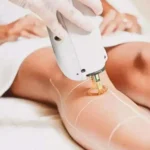 دعوت به همکاری از اپراتور لیزر خانم جهت کلینیک در شیراز