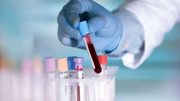 استخدام نیروی پذیرش و نمونه گیر خانم جهت شیفت عصر آزمایشگاه تشخیصی طبی در بندرعباس