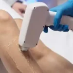 استخدام اپراتور لیزر و نیروی خدماتی جهت کلینیک زیبایی معتبر در برازجان استان بوشهر