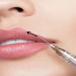 نیازپند پزشک زیبایی مسلط به تزریقات زیبایی جهت کلینیک در جهان‌شهر کرج