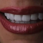 استخدام منشی جهت مطب دندانپزشکی در تهرانپارس جنوبی تهران