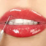 استخدام دستیار پزشک و منشی جهت کلینیک زیبایی در جردن تهران