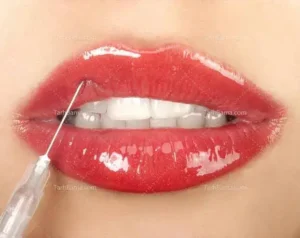 استخدام دستیار پزشک و منشی جهت کلینیک زیبایی در جردن تهران