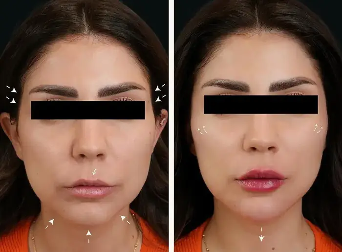 استخدام پزشک عمومی با پروانه و مسلط به امور زیبایی جهت کلینیک معتبر در مشهد