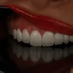 استخدام دستیار تصویر‌برداری جهت کلینیک دندانپزشکی در الهیه تهران