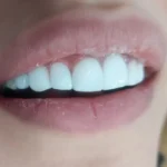 نیازمند دستیار دندانپزشک و منشی جهت مطب در حبیب الله تهران