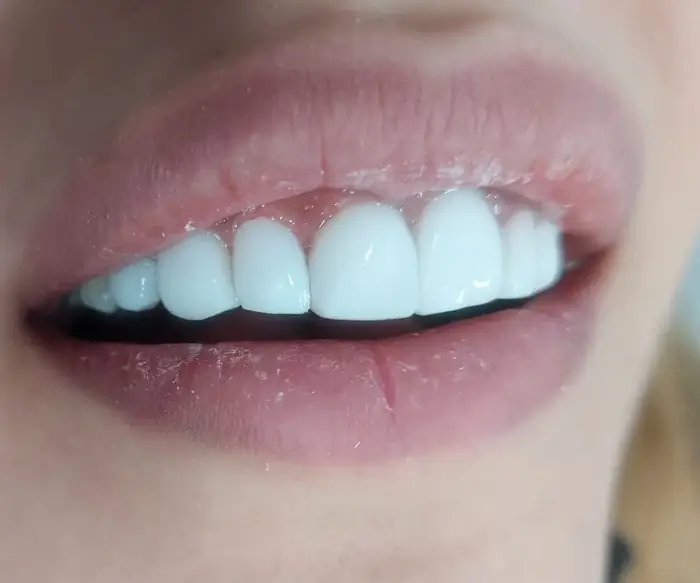 نیازمند دستیار دندانپزشک و منشی جهت مطب در حبیب الله تهران