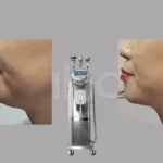 استخدام اپراتور دستگاه لاغری جهت کلینیک در خزانه تهران