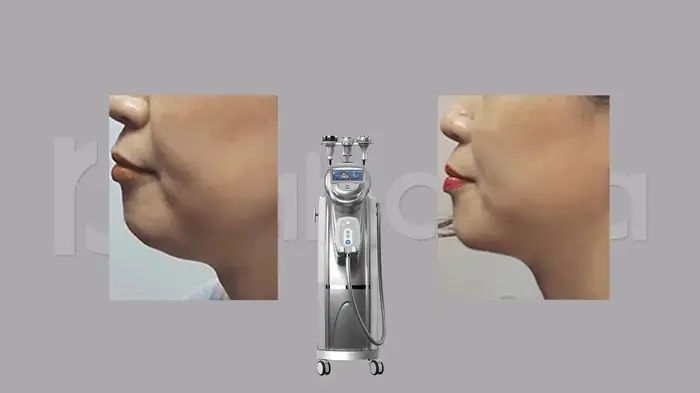 استخدام اپراتور دستگاه لاغری جهت کلینیک در خزانه تهران