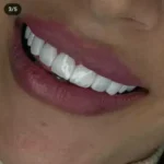 نیازمند دستیار دندانپزشک و منشی جهت کلینیک در جوادیه تهران