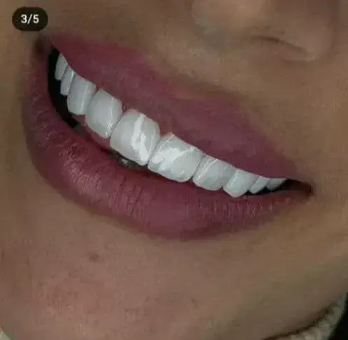 نیازمند دستیار دندانپزشک و منشی جهت کلینیک در جوادیه تهران