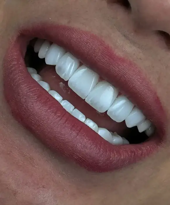 استخدام منشی و دستیار دندانپزشکی جهت مطب در هفت حوض تهران