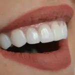 استخدام دندانپزشک در زمینه های ترمیم و زیبایی، اندو و پرتز جهت کلینیک تریتا در مشهد