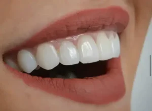 استخدام دندانپزشک در زمینه های ترمیم و زیبایی، اندو و پرتز جهت کلینیک تریتا در مشهد