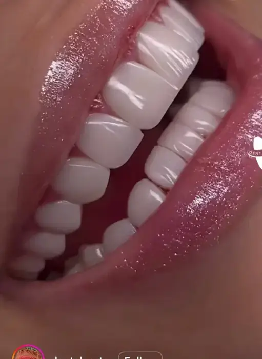 استخدام منشی خانم جهت مطب دندانپزشکی در صفادشت ملارد