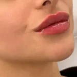 استخدام پزشک مسلط به خدمات زیبایی جهت مرکز زیبایی معتبر در قم