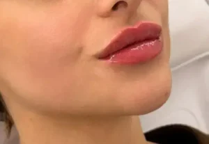 استخدام پزشک مسلط به خدمات زیبایی جهت مرکز زیبایی معتبر در قم