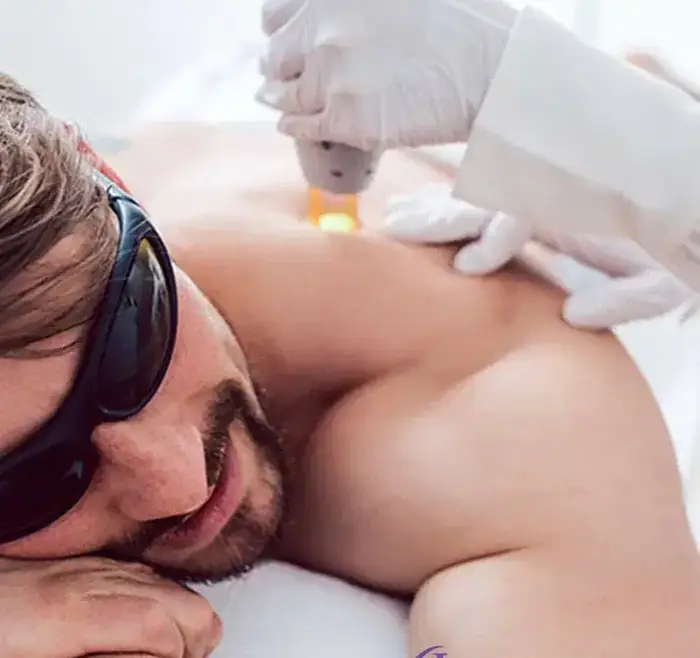 استخدام اپراتور لیزر آقا جهت مرکز زیبایی و لیزر واقع در چیتگر تهران