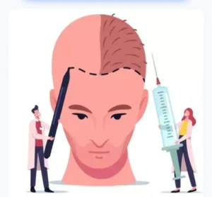 استخدام تکنسین کاشت مو جهت کلینیک معتبر در چابهار استان سیستان و بلوچستان