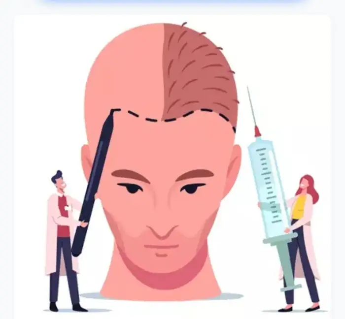 استخدام تکنسین کاشت مو جهت کلینیک معتبر در چابهار استان سیستان و بلوچستان