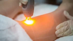 استخدام اپراتور لیزر جهت کلینیک زیبایی در اسلامشهر