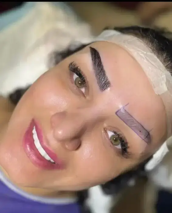 تکنسین تزریق ژل و بوتاکس هستم آماده همکاری با کلینیک‌های زیبایی در اهواز