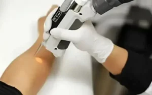 استخدام اپراتور لیزر خانم جهت کلینیک معتبر در سلیمانی تهران