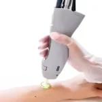 استخدام اپراتور لیزر جهت کلینیک در رشت