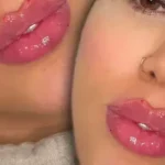 آموزش ژل و بوتاکس همراه استخدام در اصفهان