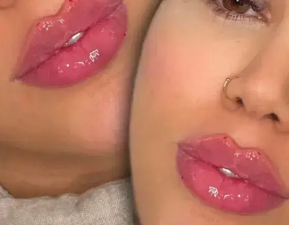 آموزش ژل و بوتاکس همراه استخدام در اصفهان