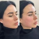 استخدام پزشک متخصص پوست و مو جهت کلینیک زیبایی معتبر در همدان