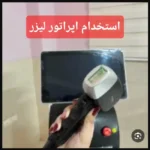 استخدام اپراتور لیزر تیتانیوم جهت کلینیک زیبایی معتبر در محدوده نارمک تهران