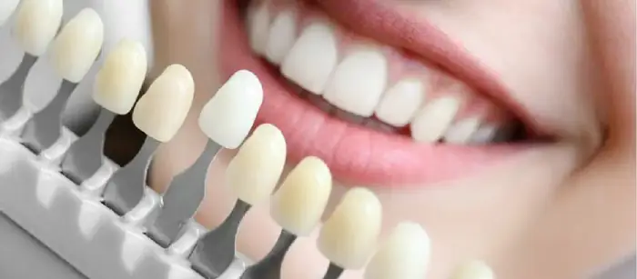 فروش مواد دندانسازی، بلنک زیرکونیا، گلس سرامیک در اصفهان