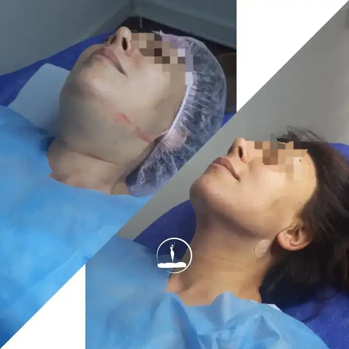 استخدام منشی خانم جهت مطب لیپوماتیک و پیکرتراشی در قیطریه تهران