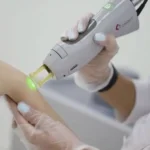 استخدام اپراتور لیزر جهت کلینیک پوست و مو در شهریار