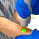 استخدام اپراتور لیزر خانم جهت مطب در همدان