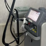 استخدام اپراتور کندلا جهت کلینیک معتبر در اصفهان