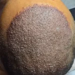 استخدام پزشک متخصص پوست و مو جهت درمانگاه تخصصی پوست و مو در چابهار